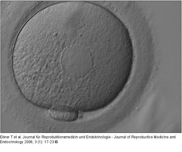 Oozyte - Endoplasmatisches Retikulum