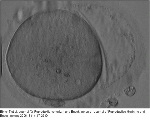 Oozyte - Zona pellucida