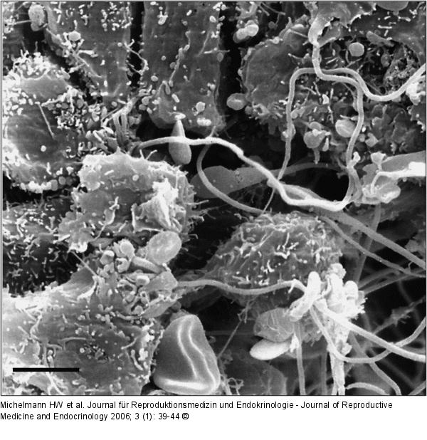 Corona radiata - Oozyten