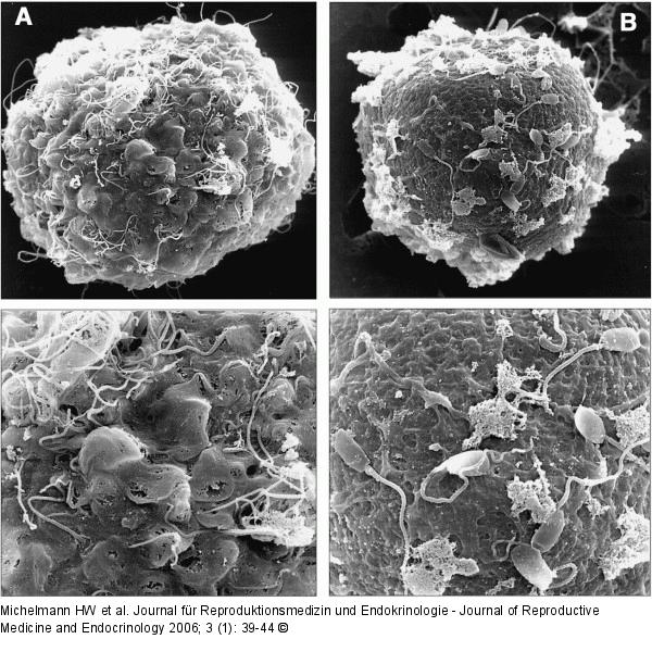 Spermatozoon - Blastozyste