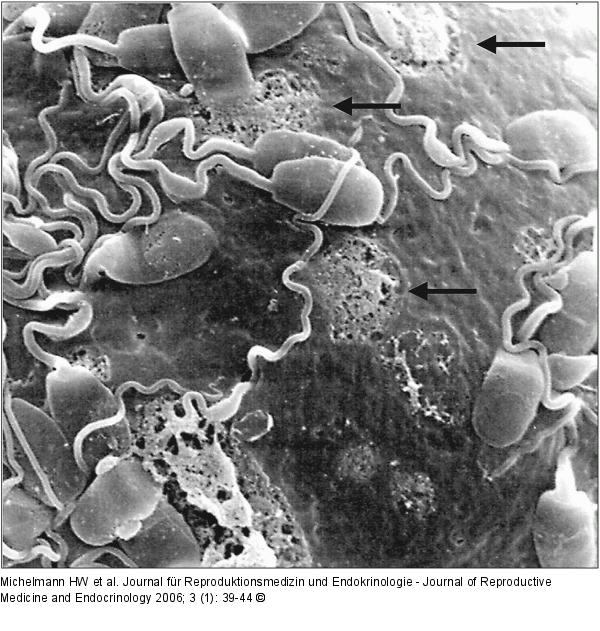 Zona pellucida - Enzymatische Lyse