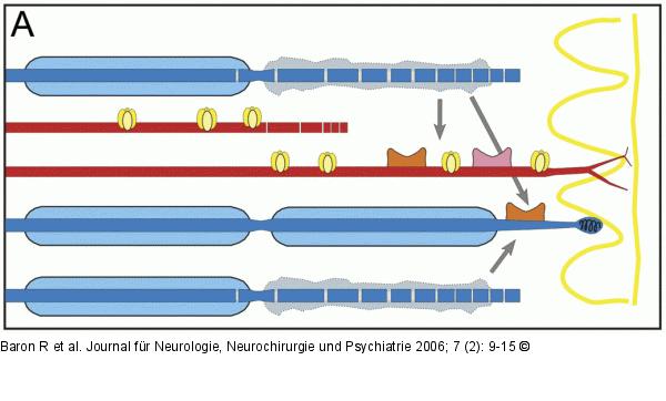 Nervenläsion - Primär afferente Neurone