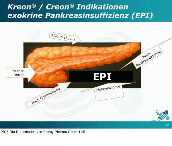 Exokrine Pankreasinsuffizienz
