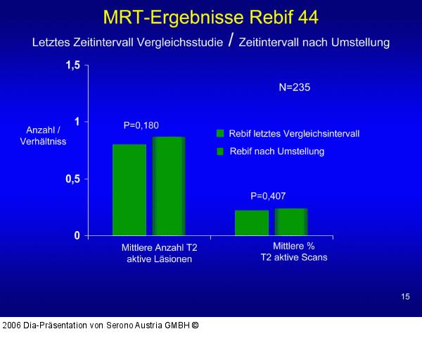 MRT-Ergebnisse  - Rebif