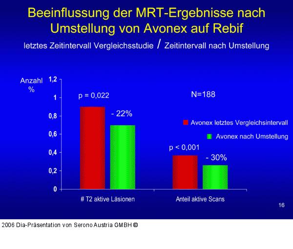 MRT-Ergebnisse - Umstellung - Avonex - Rebif