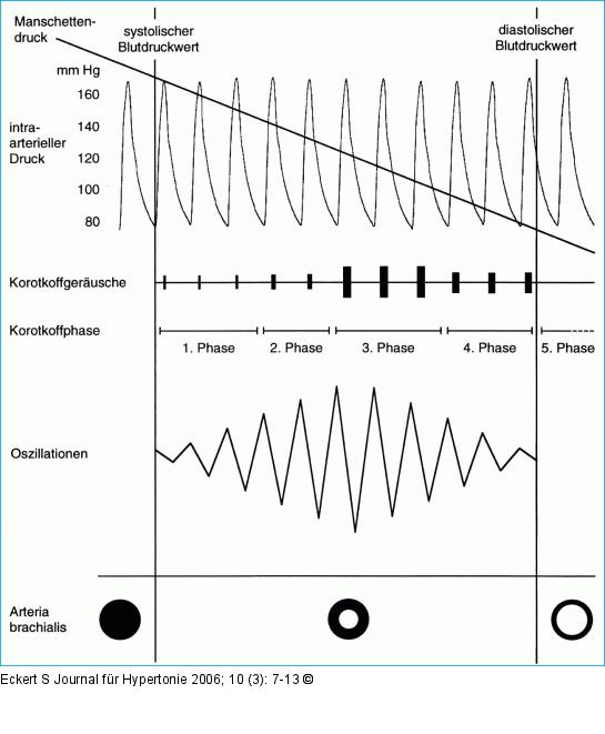 Blutdruckmessung - Methoden