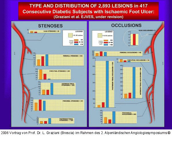 Diabetes mellitus - Ischämie