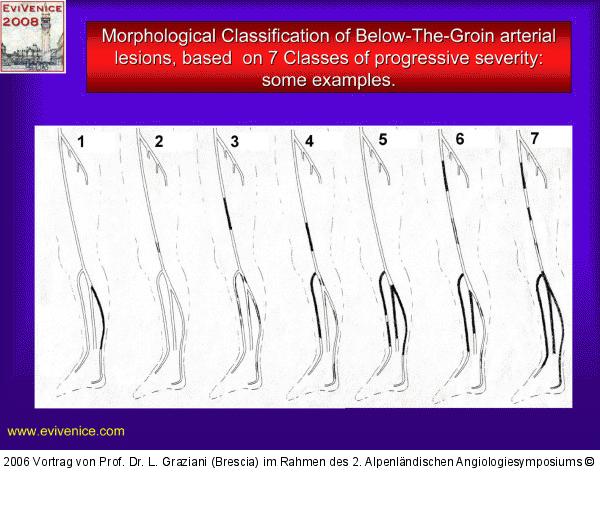 Läsion - Klassifikation