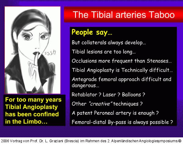 Tibialarterie
