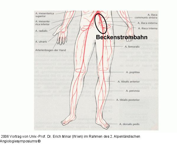 Beckenstrohmbahn