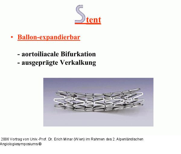 Stent