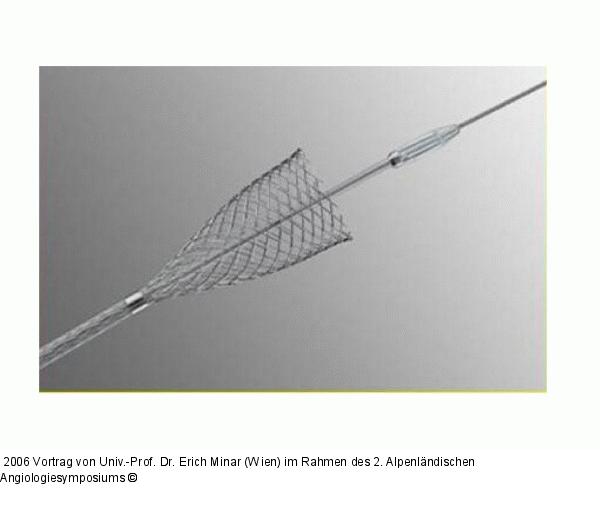 Stent