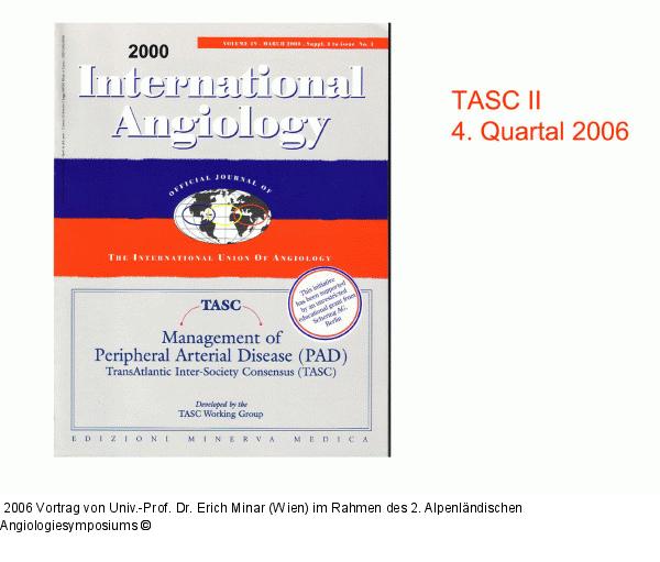TASC II