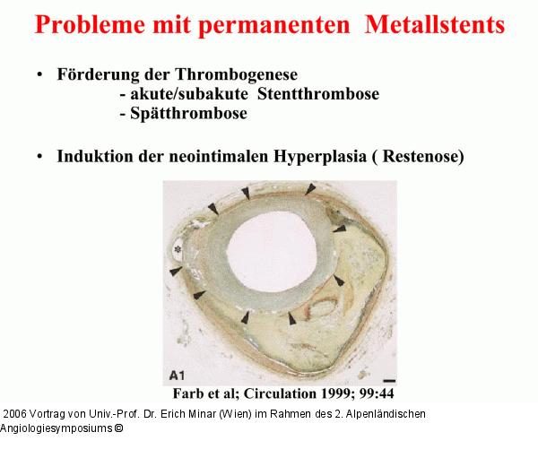 Permanente Metallstents