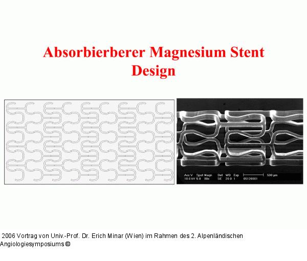 Absorbierbarer Magnesium Stent