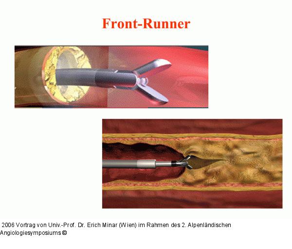Front-Runner