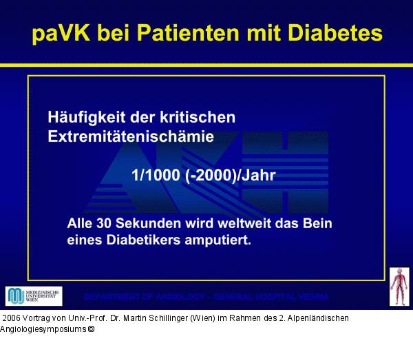PAVK - Diabetes mellitus