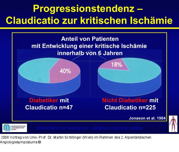 Progressionstendenz