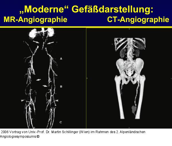 Magnetresonanz - Computertomographie