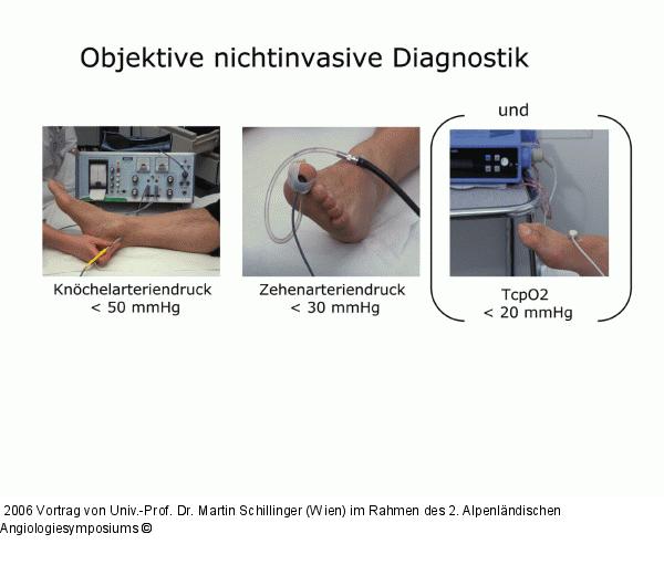 Objektive nichtinvasive Diagnostik