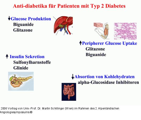 Diabetes mellitus Typ 2 - Antidiabetika