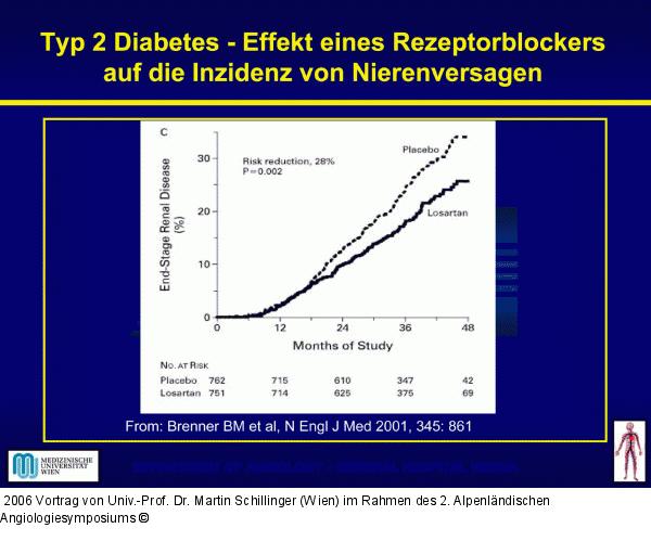 Diabetes mellitus Typ 2
