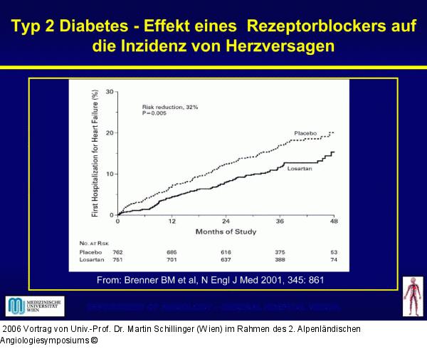 Diabetes mellitus Typ 2