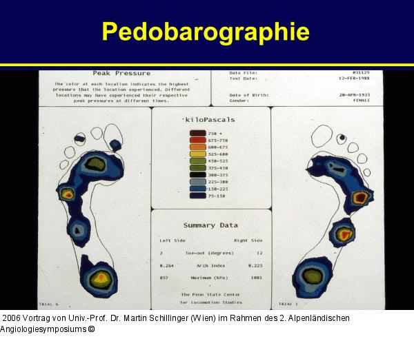 Pedobarographie