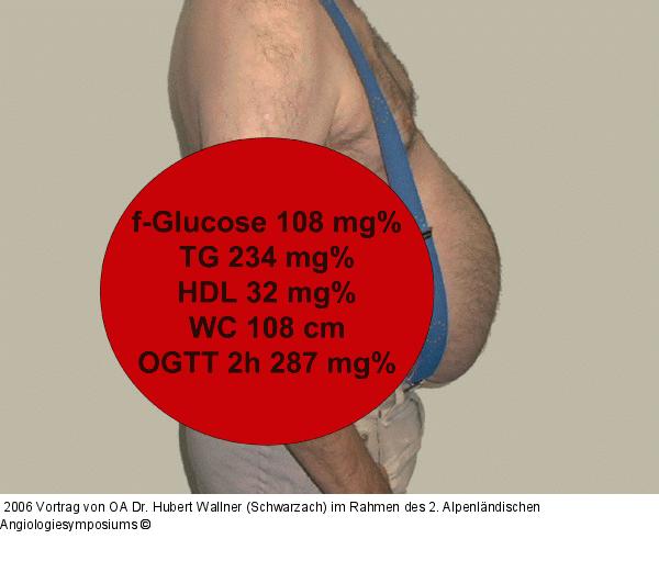 Adipositas - Fallbeispiel