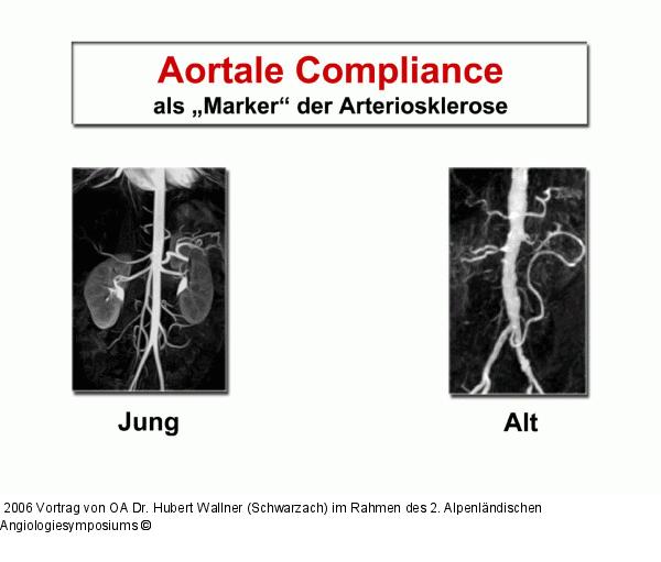Aortale Compliance
