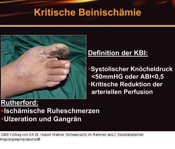 Kritische Beinischämie