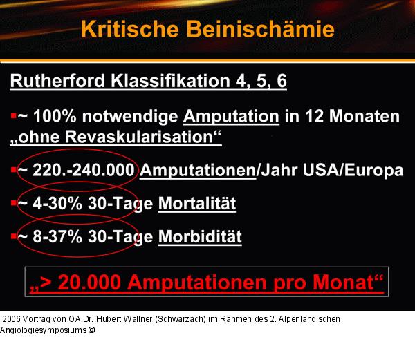 Kritische Beinischämie