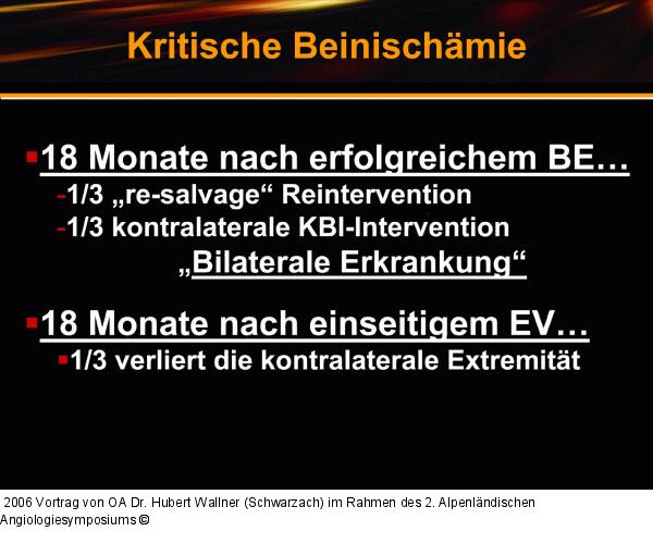 Kritische Beinischämie