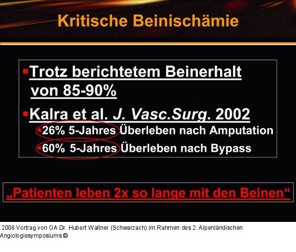 Kritische Beinischämie