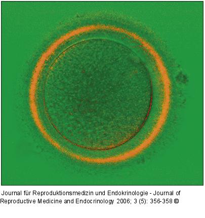 Zona pellucida - Doppelbrechung