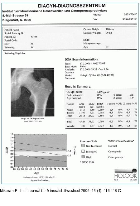 DXA-Scan - Femur
