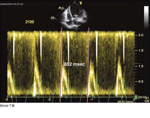 Bestimmung der Zykluslänge