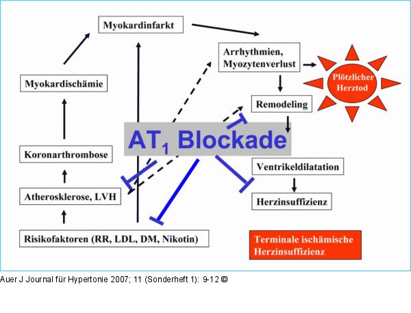 Herzinsuffizienz - Progression