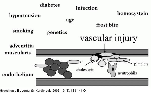 Vascular Disease - Gefäßerkrankung