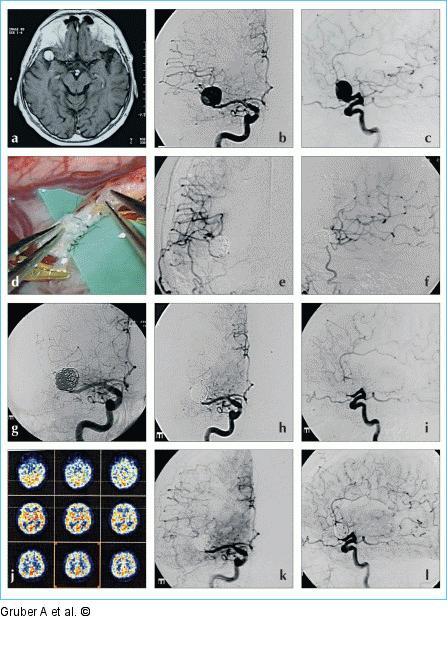 Kombinierte Therapie