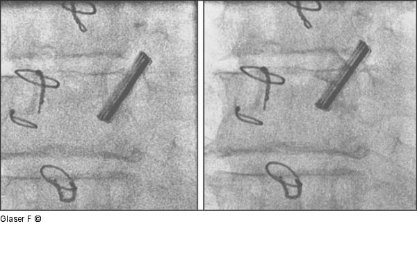 Durchleuchtung Projektion
