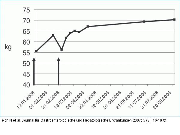 Morbus Crohn