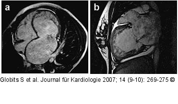 Gradientenechosequenz
