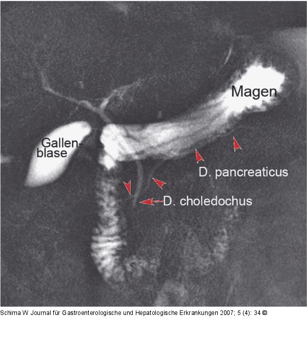 Ductus choledochus