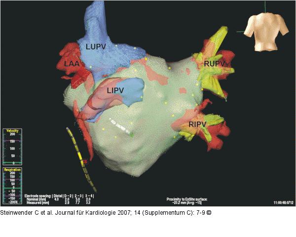 CT - Virtuelle Anatomie