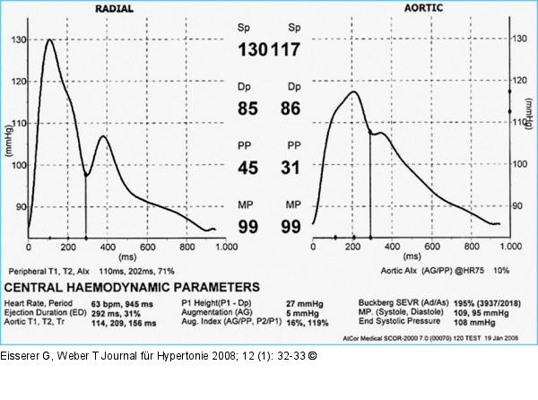 Pulswellenanalyse