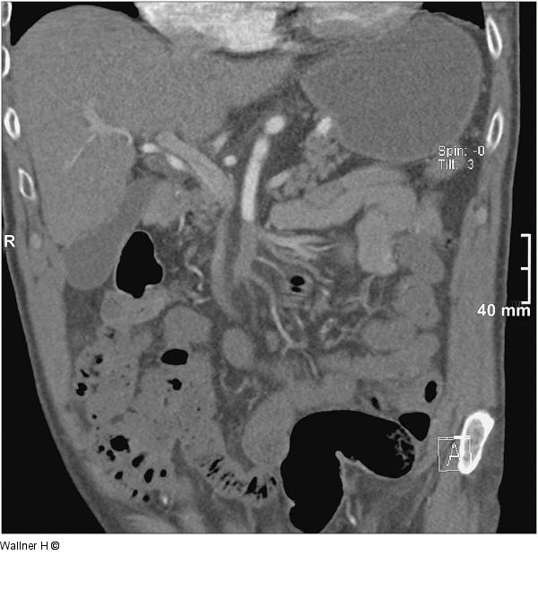 A. mesenterica superior