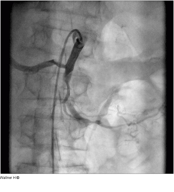 A. mesenterica superior