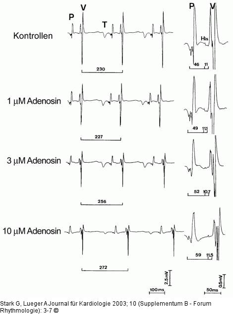 Wirkung von Adenosin