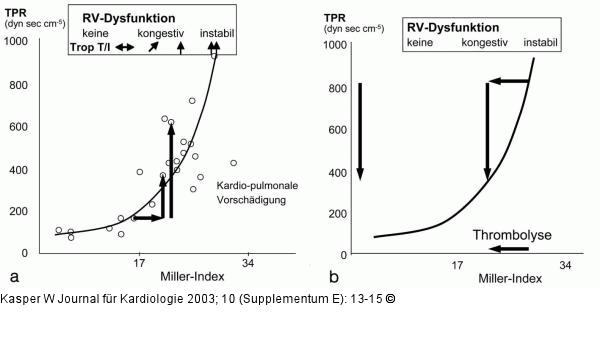 Pulmonale Gefäßobstruktion - Pulmonaler Gefäßwiderstand